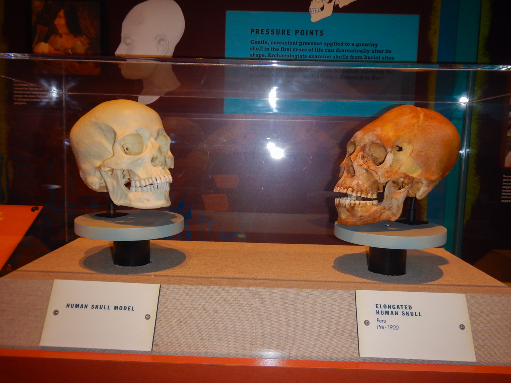 Cranial Deformation